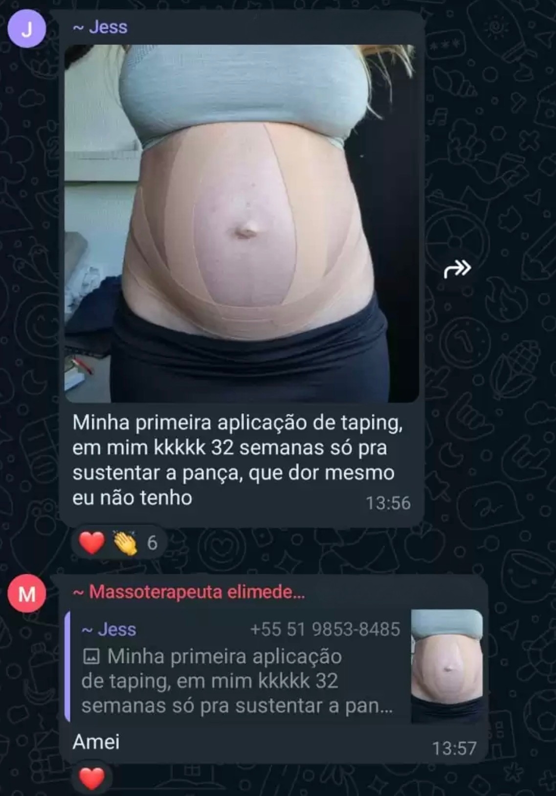 Depoimento de Jess - Aplicação de taping às 32 semanas para sustentar a barriga
